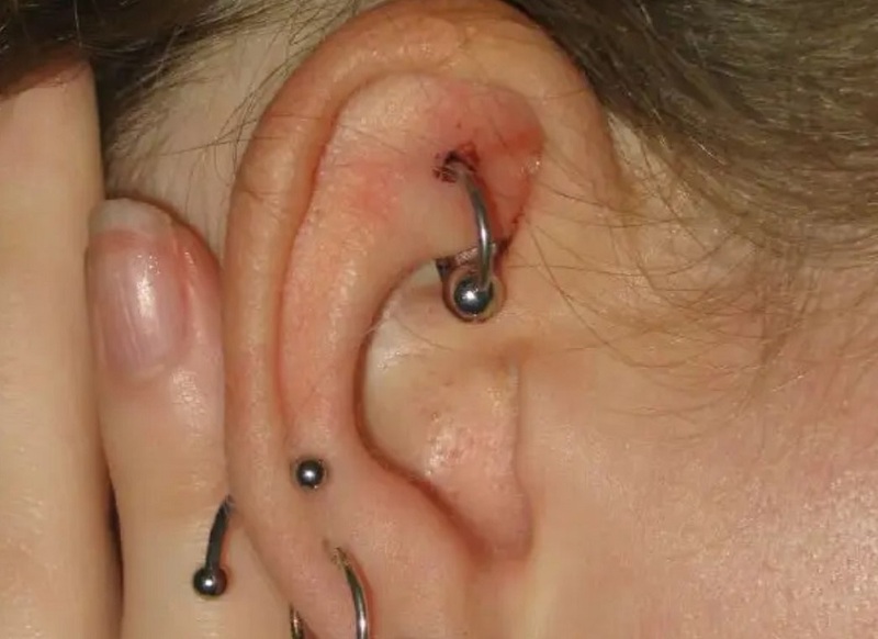 Need to Know Before Piercing Your Ears
