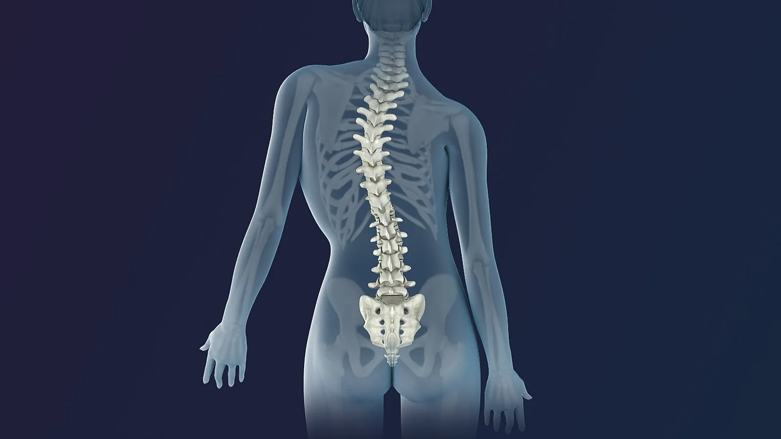 Scoliosis Pain: Causes, Symptoms, and Treatment